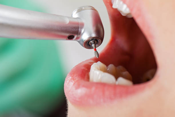 Best Emergency Denture Repair in Portage Lakes, OH